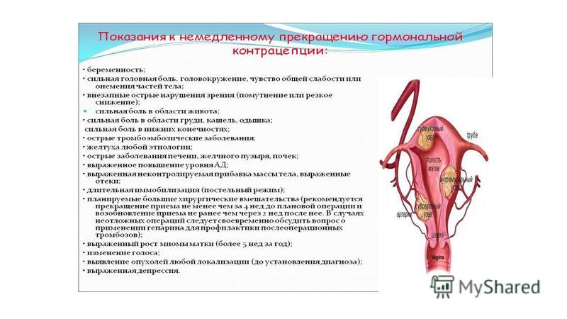 Как можно снять спираль Удаление Мирены Месячные - Telegraph