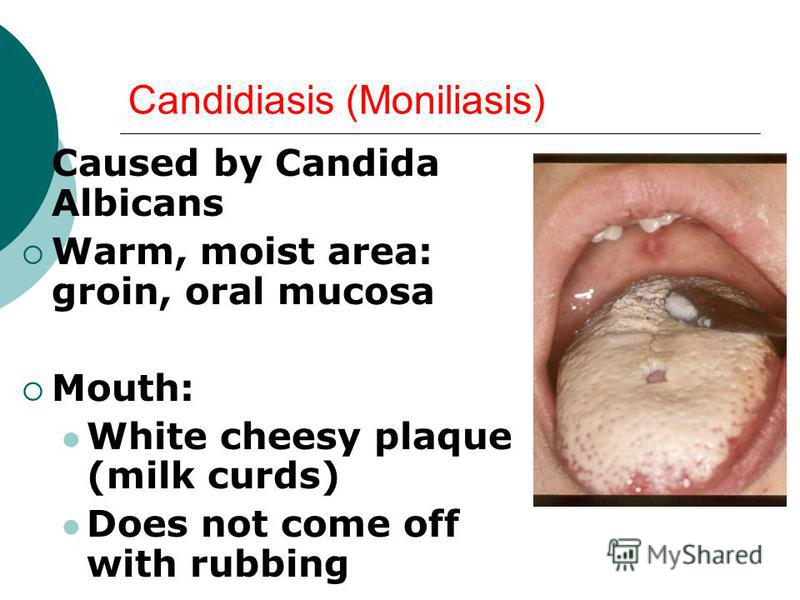 Oral Mucosa Is Moist 4