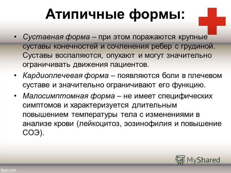 Воспаляются суставы и горят ноги. Косточка на большом пальце ноги: лечение в домашних условиях, операция. Почему горят ноги ступни: Горят стопы (подошвы ног) – причины и что. Болят Суставы И Отекают Ноги — Buy-artox.ru