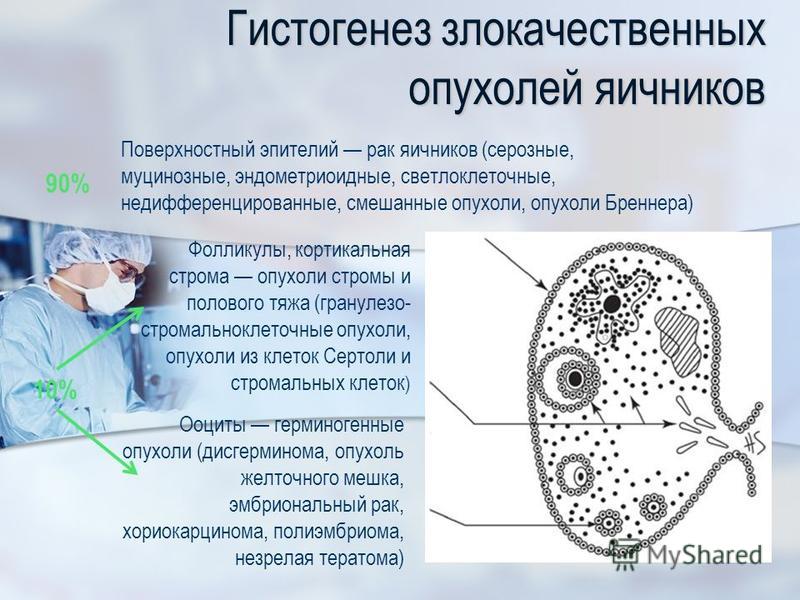 Презентация на тему рак яичников