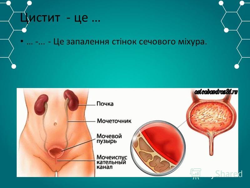 Реферат: Захворювання нирок і сечовивідних шляхів