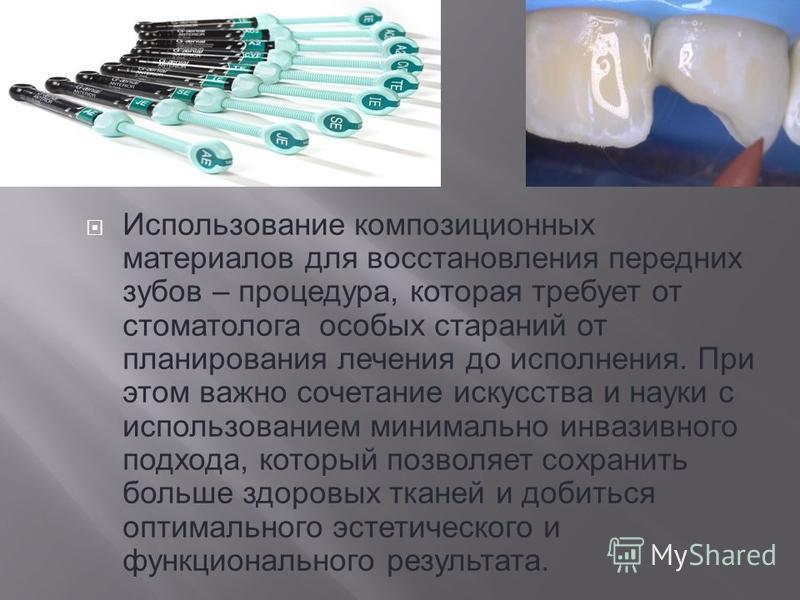 Примеры использования композиционных материалов в машиностроении презентация