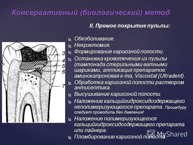 Ошибки и осложнения при лечении пульпита презентация