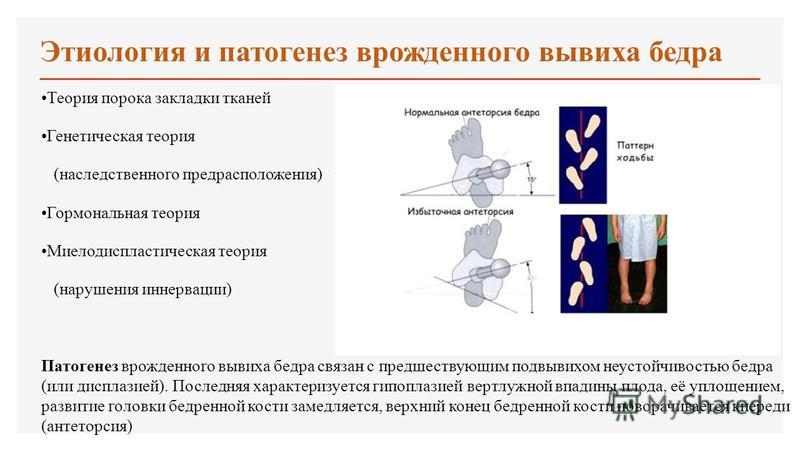 Пороки развития опорно двигательного аппарата презентация