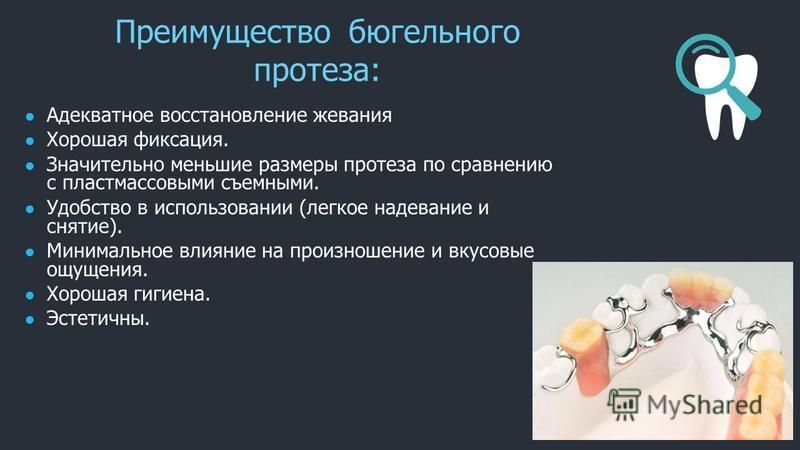 Конструктивные элементы бюгельных протезов их расположение