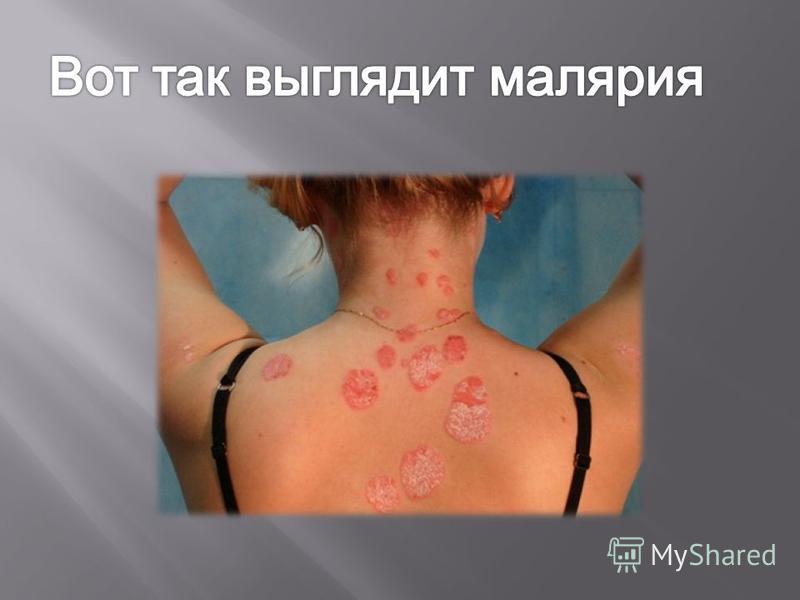как выходят паразиты из организма как выходят паразиты из организма