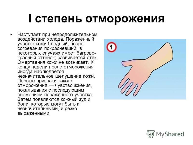 Презентация на тему отморожение