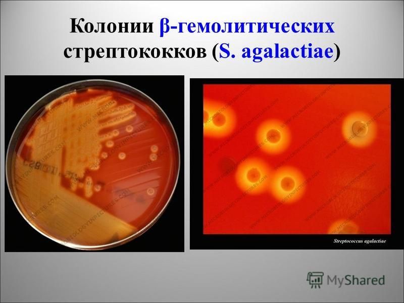 A sisakokat mikroorganizmusok okozzák)