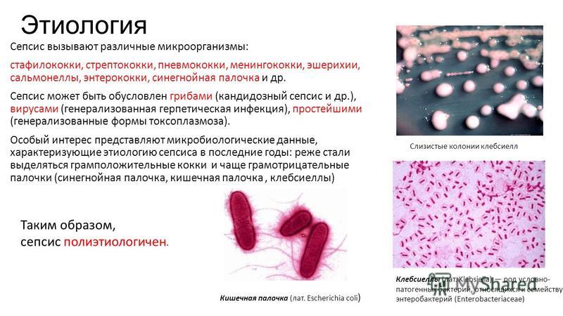 Презентация на тему сепсис