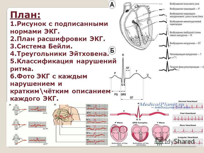 Горло план расшифровка