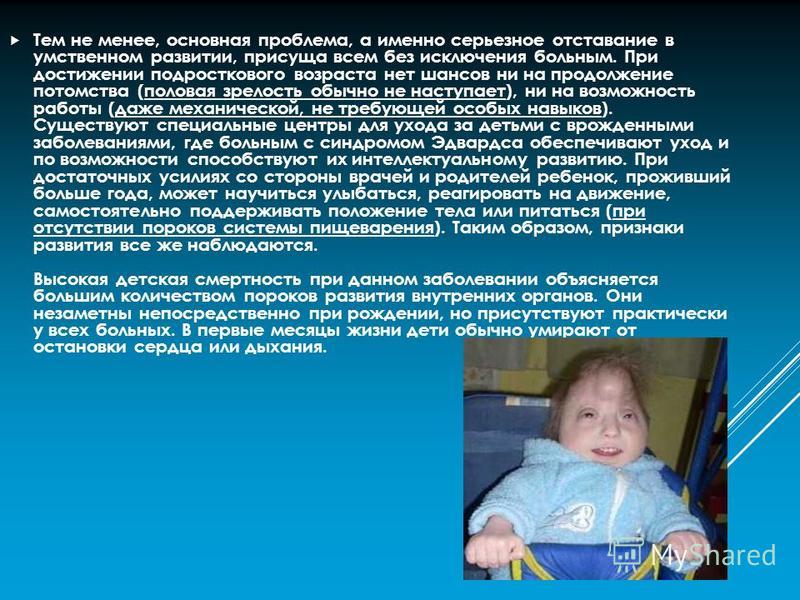 Реферат На Тему Синдром Эдвардса Реферат На Тему Синдром Эдвардса