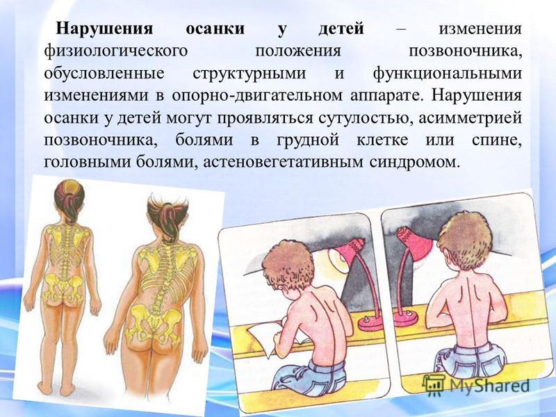 Осанка у детей дошкольного возраста. Нарушение осанки у детей | Консультация: | Образовательная социальная сеть Презентация на тему: "Формирование правильной осанки у детей. Рекомендации для родителей "Профилактика нарушения осанки у детей.