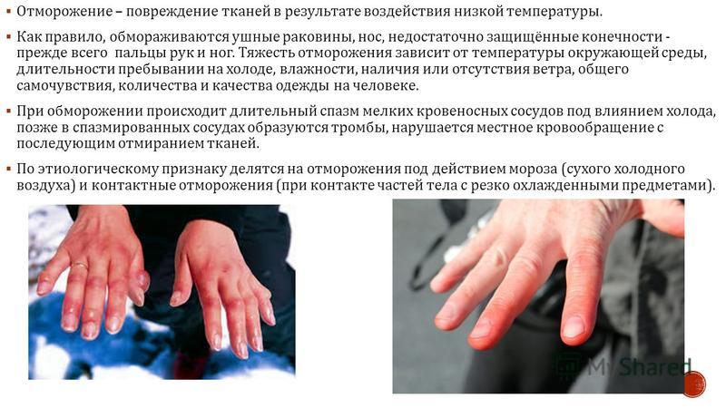 Как выглядит обморожение пальцев рук Презентация на тему отморожение