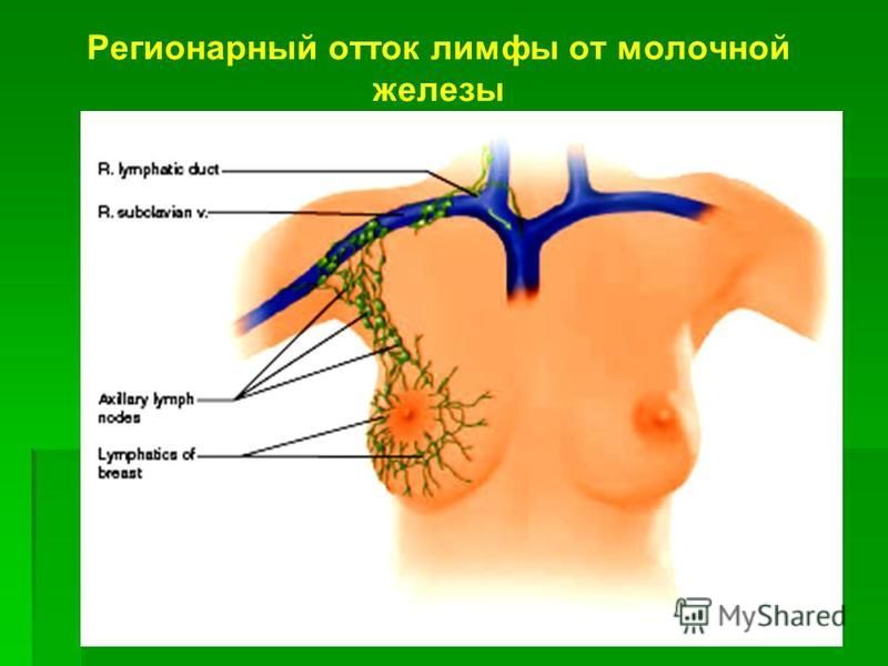 Схема лимфооттока от молочной железы