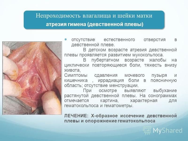 девственные влагалища" 