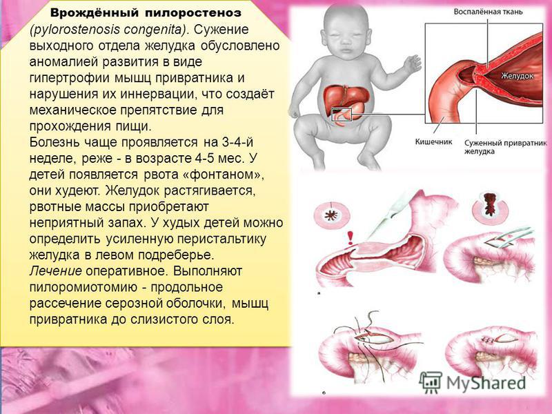 Самая модна одежда этого лета женская Самая модна одежда этого лета женская
