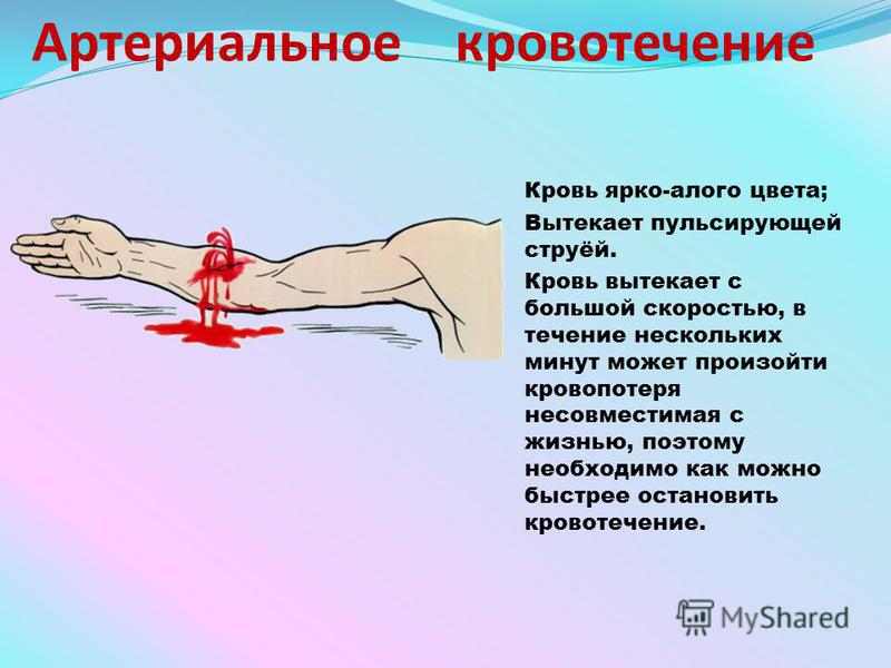 почему кровь алого цвета почему кровь алого цвета