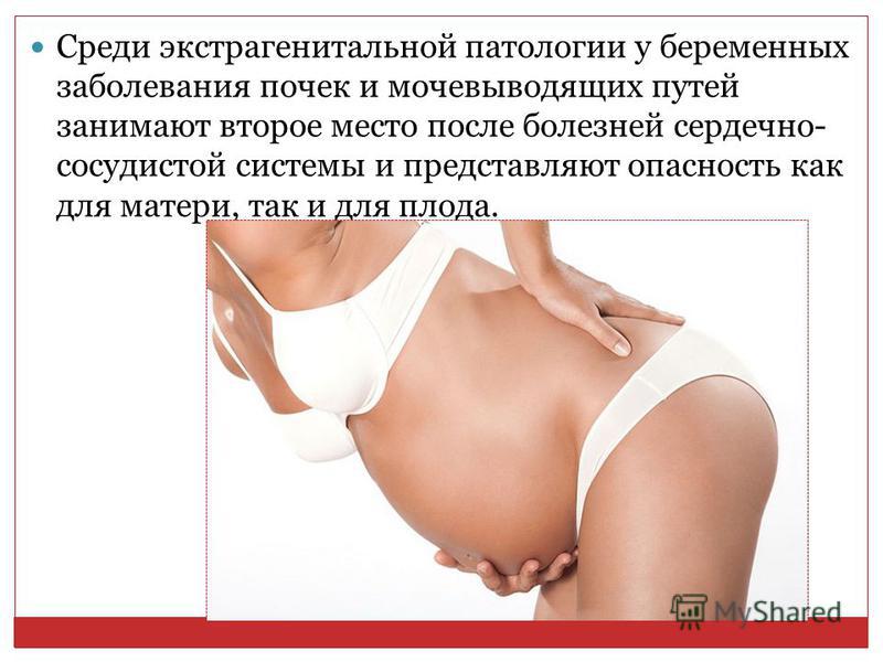 Лечение мочекаменной болезни у беременных 37