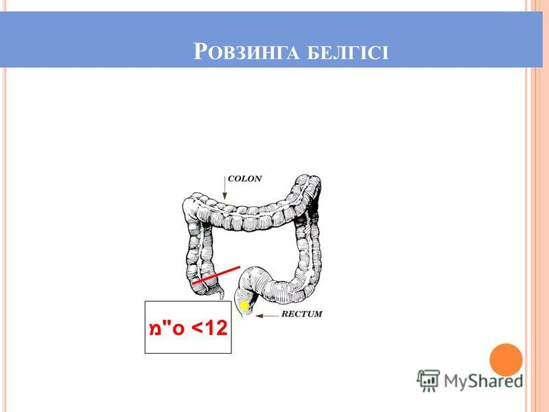 Признаки аппендицита у детей Признаки аппендицита у детей