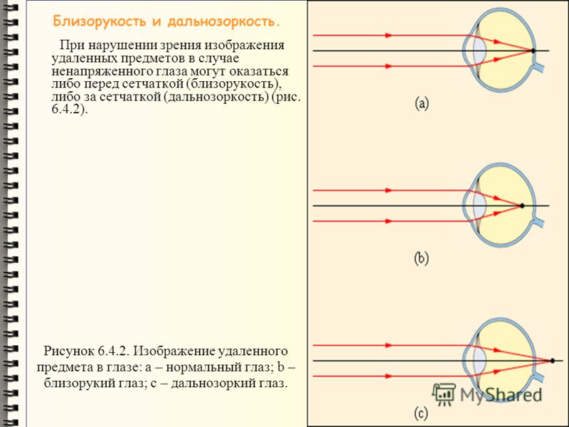 Лечение глаз и зрения народными средствами