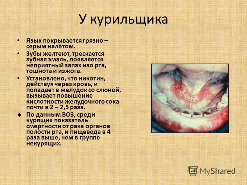 мозг запах изо рта мозг запах изо рта
