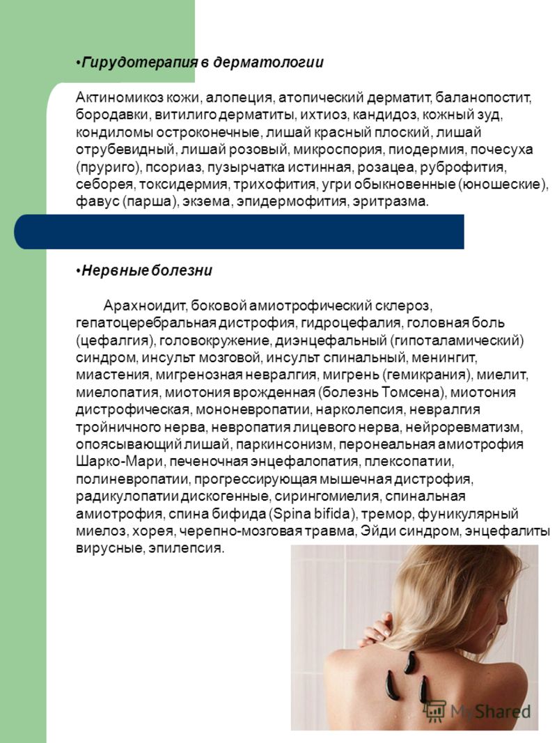 Чем убрать мокнущую экзему