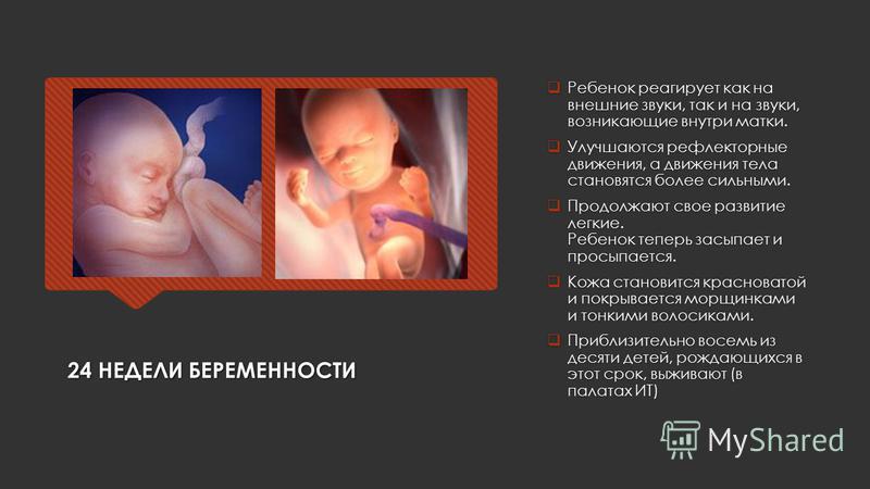 Беременные 24 недели беременности Беременные 24 недели беременности