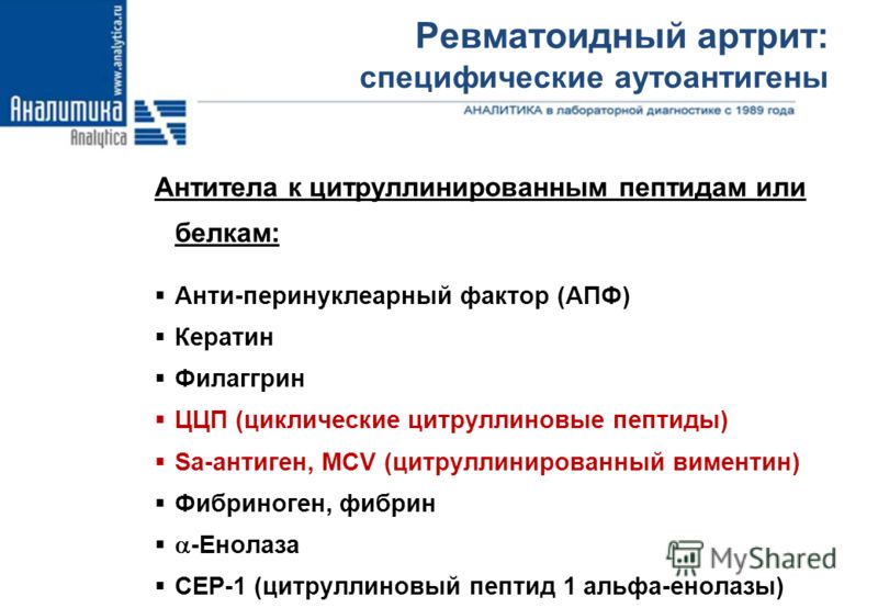 Критерии ревматоидного артрита Критерии ревматоидного артрита