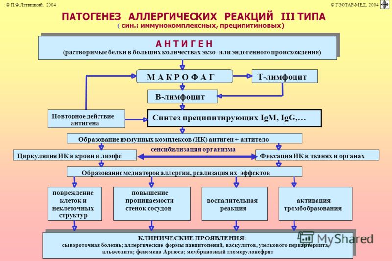 При напряжении живота болит внизу
