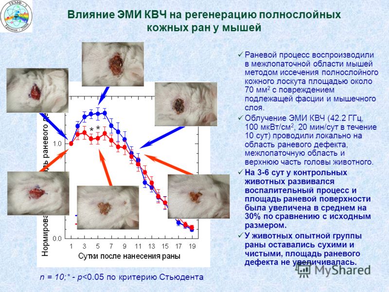 Влияние ЭМИ КВЧ на регенерацию полнослойных кожных ран у мышей Раневой процесс воспроизводили в межлопаточной области мышей методом иссечения полносло