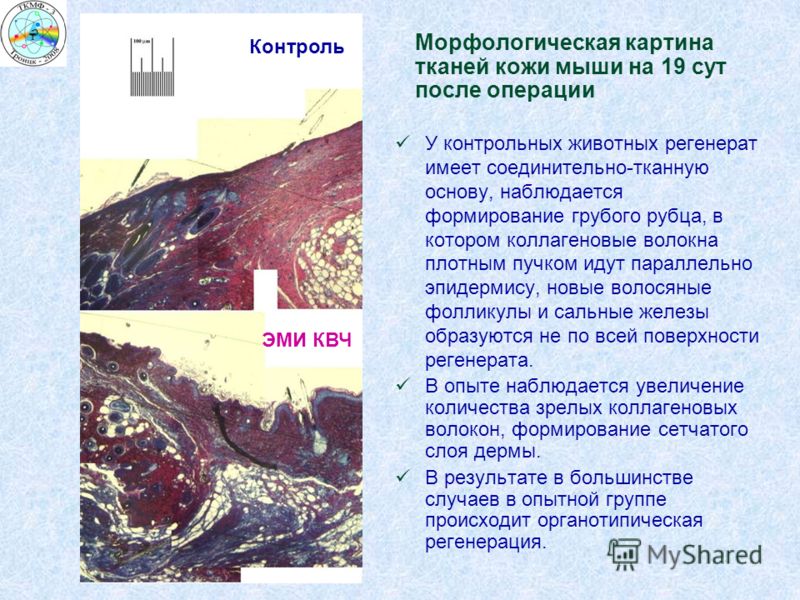 Морфологическая картина тканей кожи мыши на 19 сут после операции У контрольных животных регенерат имеет соединительно-тканную основу, наблюдается фор