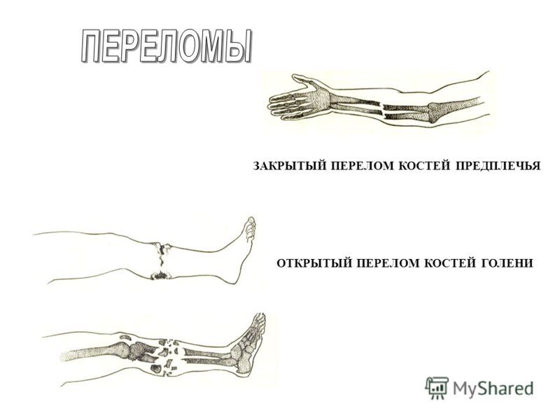 24 недели беременности болит между ног