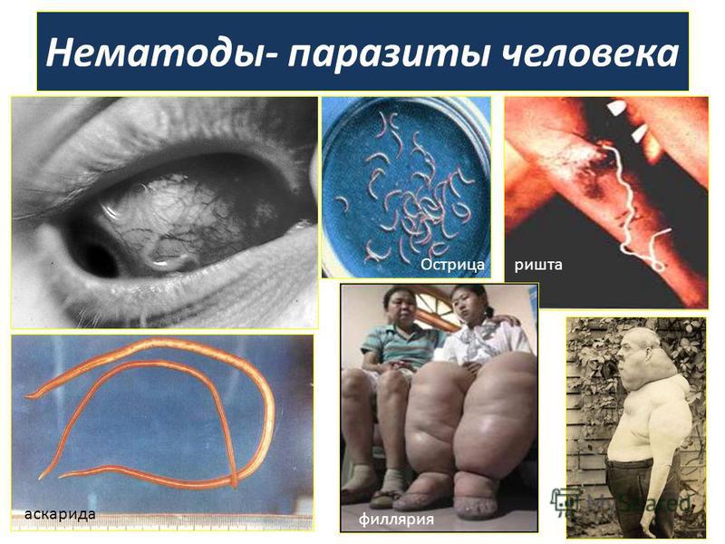 паразиты человеке лечение лекарства паразиты человеке лечение лекарства