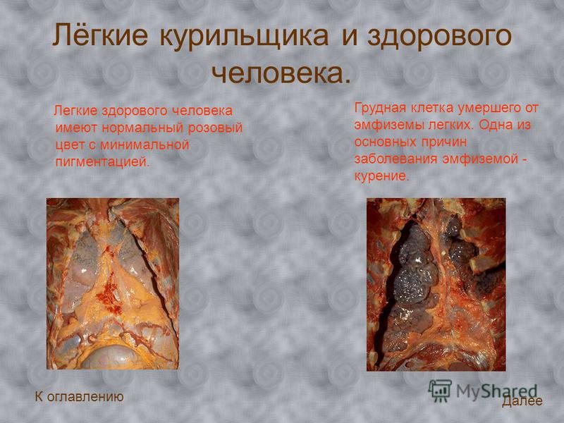 Может ли болеть ухо после удаления пробки