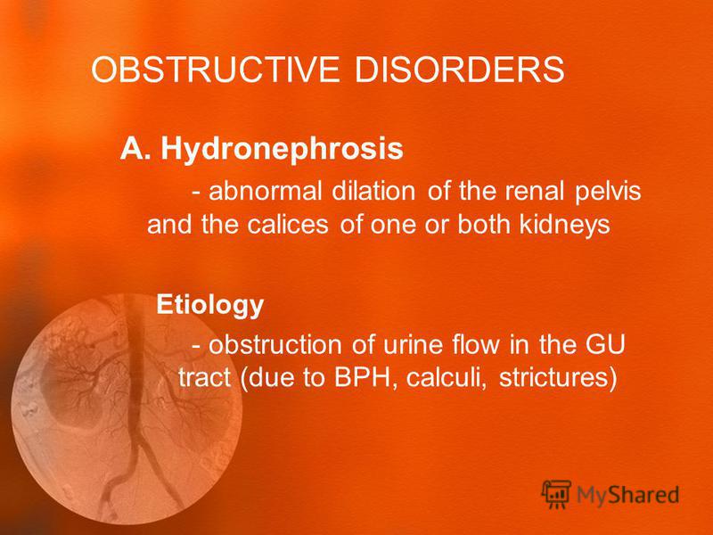 human physiological disorders Stress effects on the body musculoskeletal system this may trigger other reactions of the body and even promote stress-related disorders for example. human physiological disorders Stress effects on the body musculoskeletal system this may trigger other reactions of the body and even promote stress-related disorders for example.