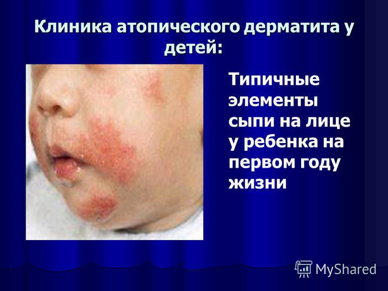 Рецепты пошагово картошки в мультиварке панасоник Рецепты пошагово картошки в мультиварке панасоник