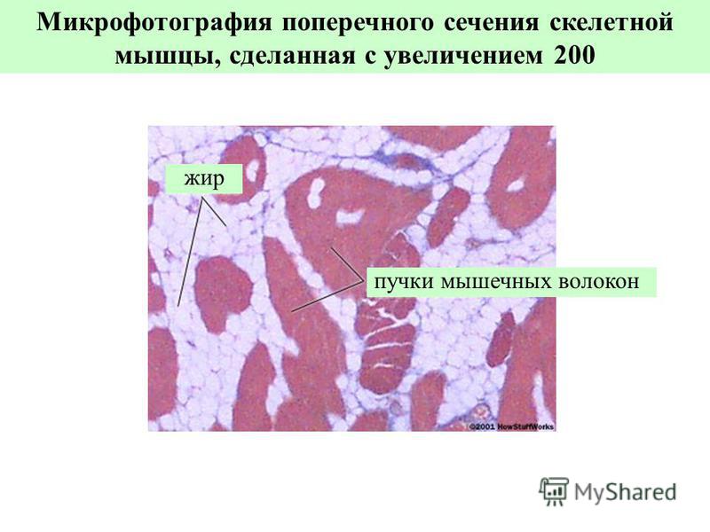 пучки мышечных волокон жир Микрофотография поперечного сечения скелетной мышцы, сделанная с увеличением 200