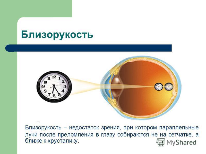 Спортивные очки для коррекции зрения купить