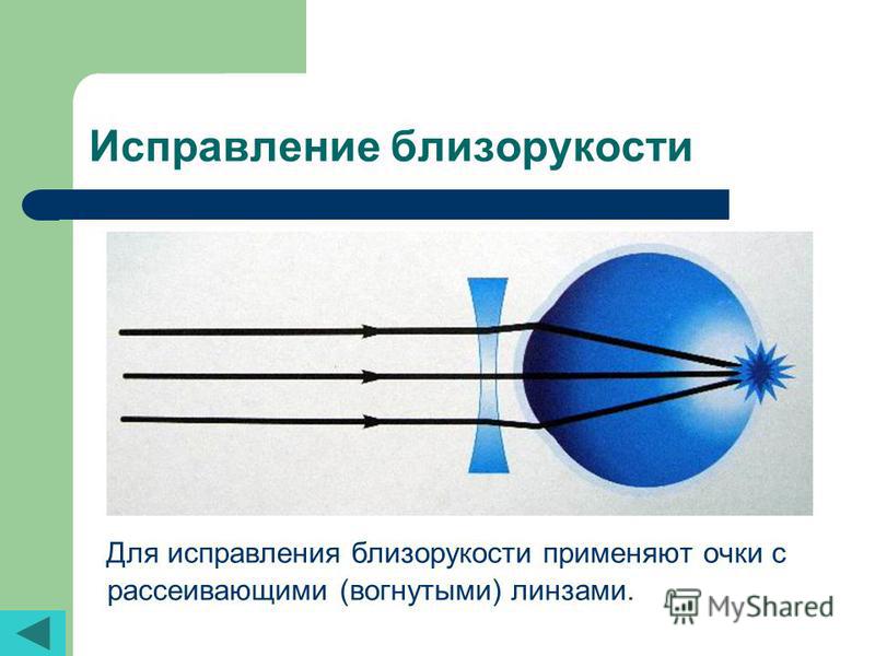 Центр контактной коррекции зрения москва тверская