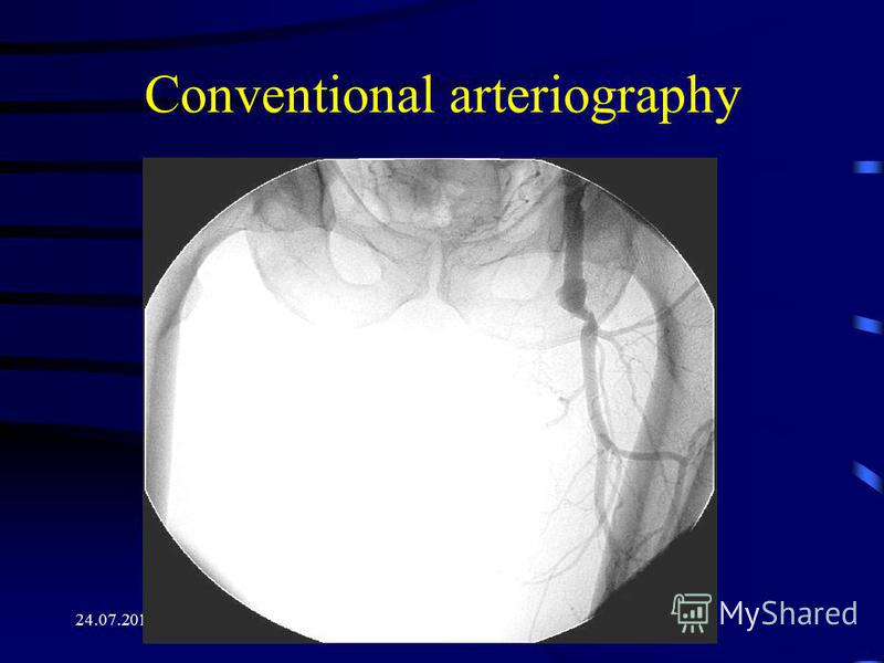 24.07.2015 18:12 Conventional arteriography