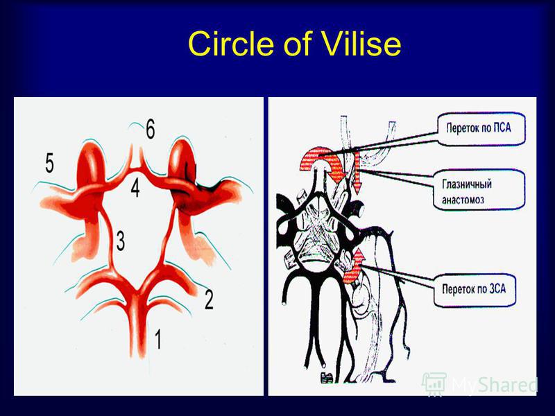 Circle of Vilise