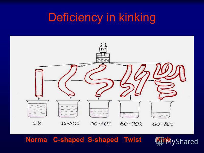 Deficiency in kinking Norma С-shaped S-shaped Twist Kink