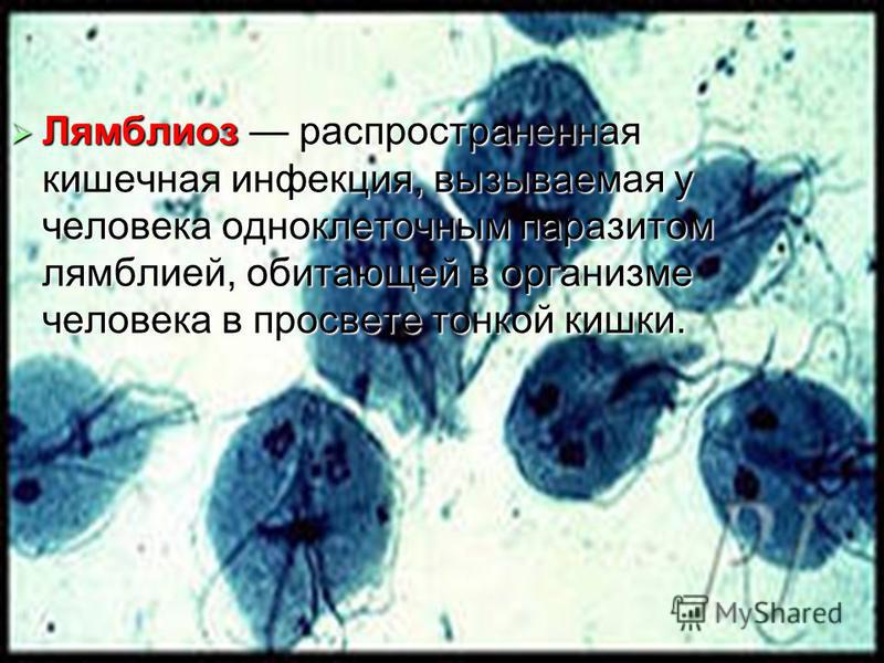 Лямблиоз распространенная кишечная инфекция, вызываемая у человека одноклеточным паразитом лямблией, обитающей в организме человека в просвете тонкой кишки. Лямблиоз распространенная кишечная инфекция, вызываемая у человека одноклеточным паразитом ля