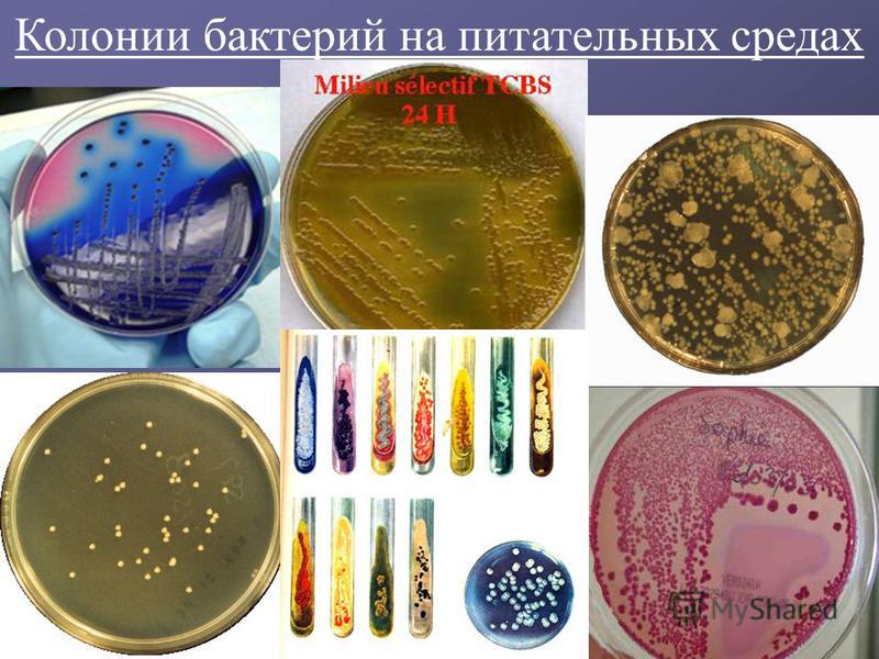 Выращивание микроорганизмов на питательных средах это 954