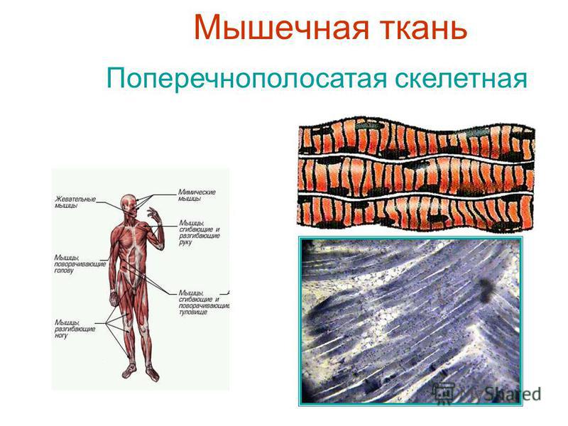 Мышечная ткань Поперечнополосатая скелетная