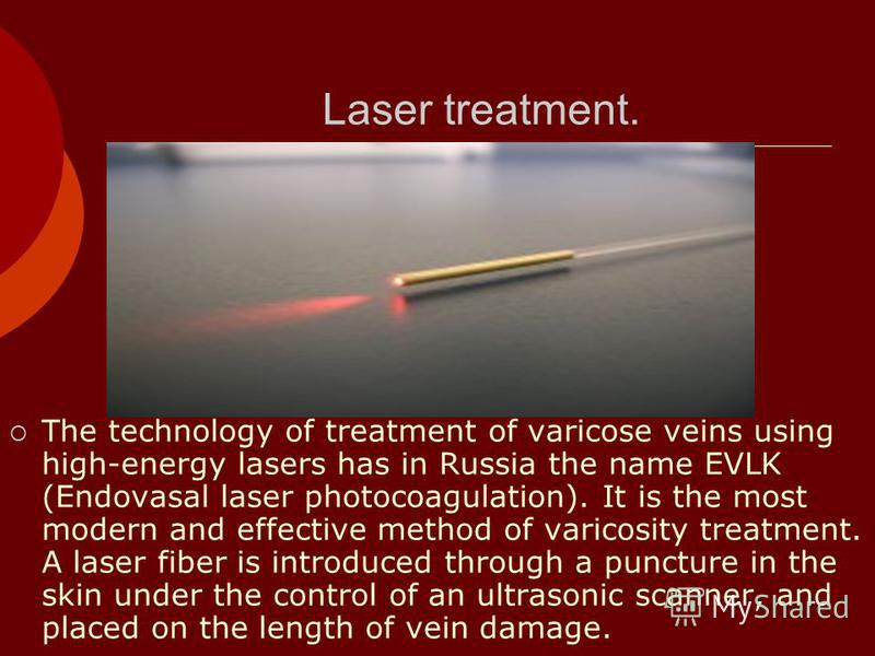 Laser treatment. The technology of treatment of varicose veins using high-energy lasers has in Russia the name EVLK (Endovasal laser photocoagulation). It is the most modern and effective method of varicosity treatment. A laser fiber is introduced th