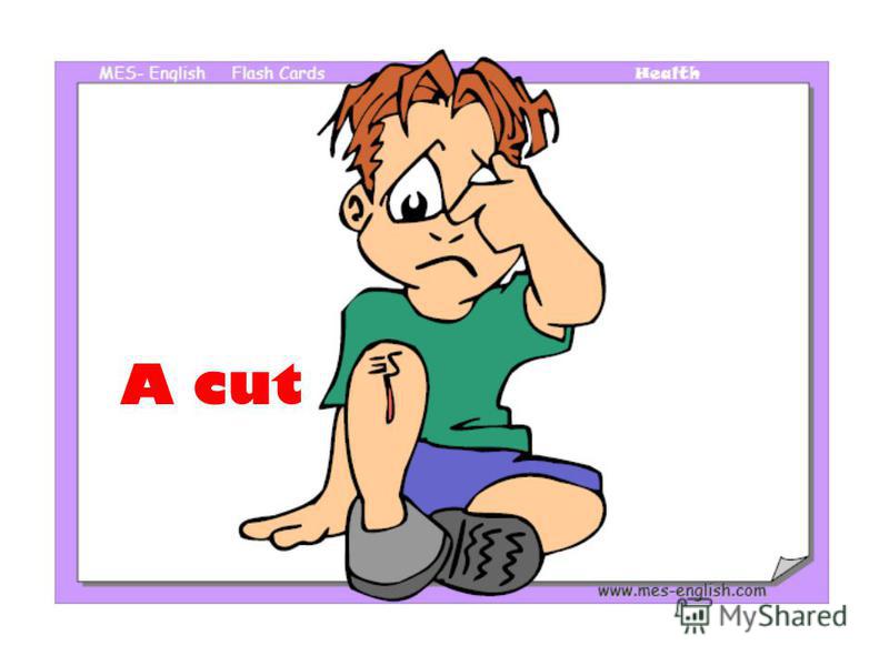 A cut