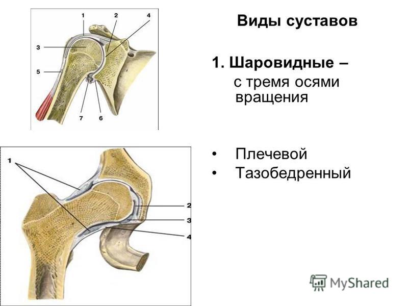 Вышел камень при мочеиспускании у мужчин Вышел камень при мочеиспускании у мужчин