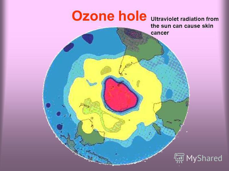 Ozone hole Ultraviolet radiation from the sun can cause skin cancer