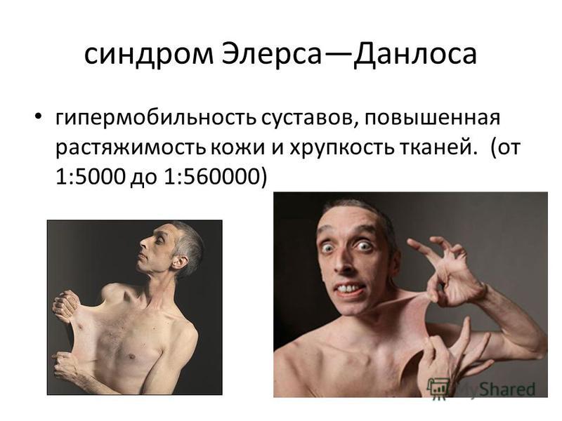 Код мкб-10 доа тазобедренного сустава Код мкб-10 доа тазобедренного сустава